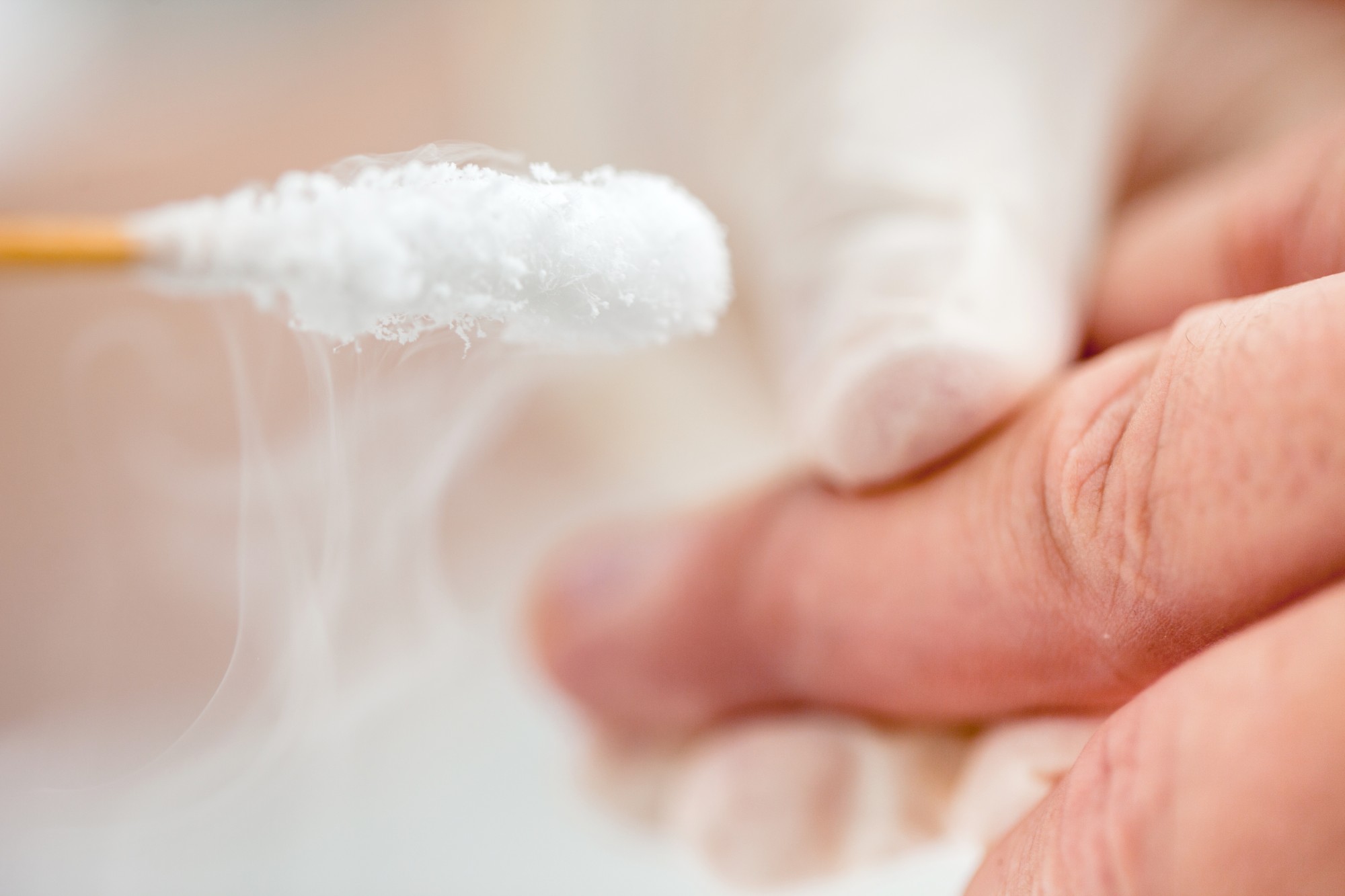 Cryotherapie