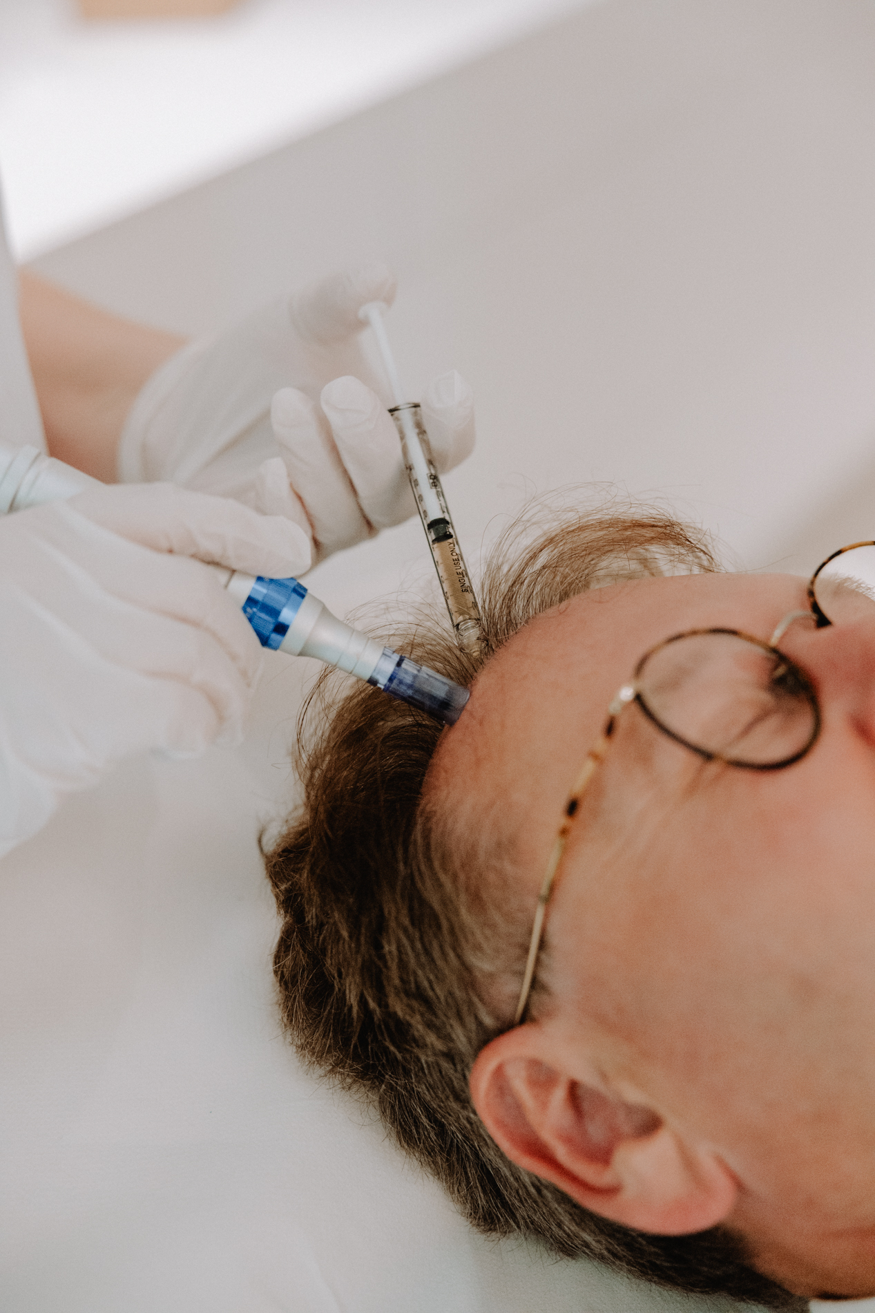 Hoe verloopt een haar filler behandeling? 