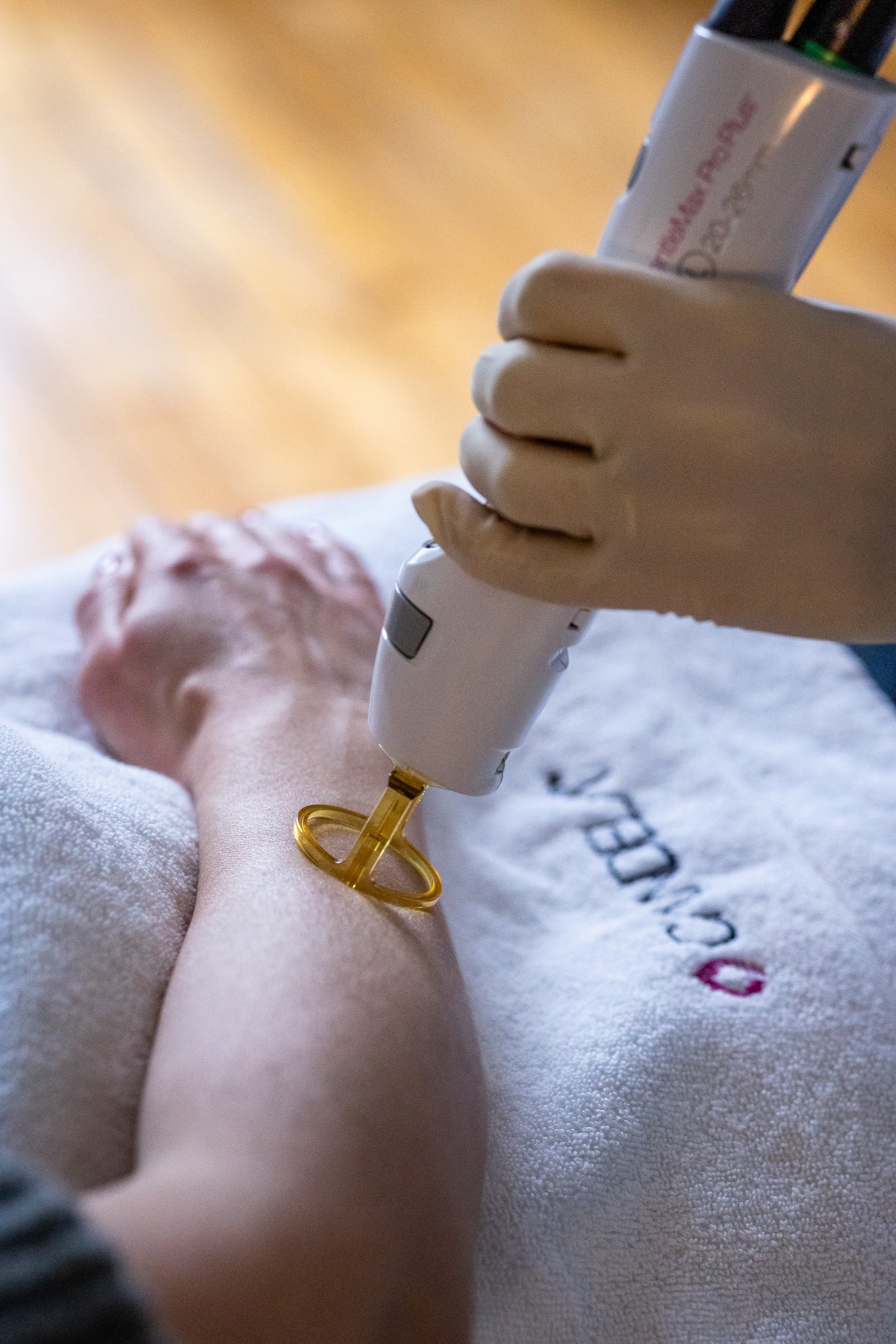 Wat zijn de voordelen van laserontharing?