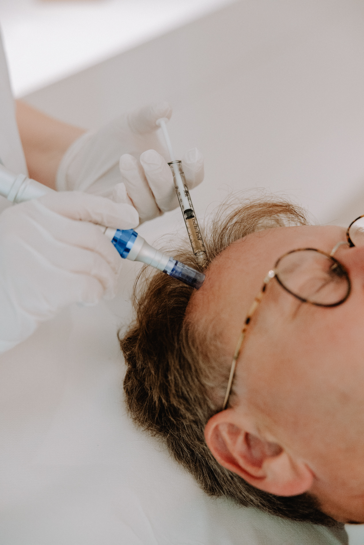 Our treatments for Hair Loss